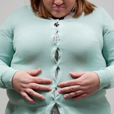 Obesity Linked to Kidney Stones