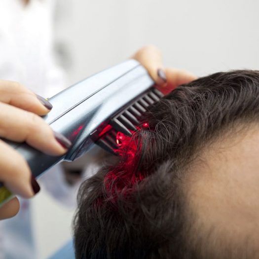 Laser Hair Therapy