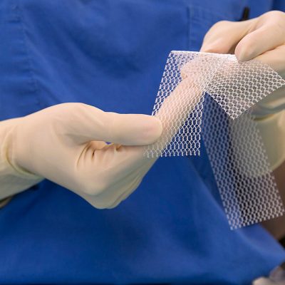 New vaginal mesh guidelines ‘insufficient’ and potentially harmful