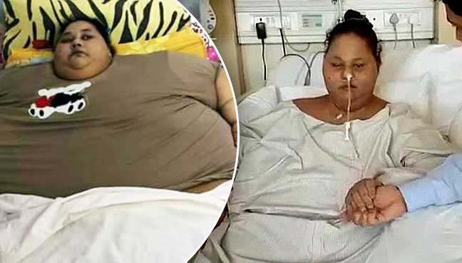 Weight-loss surgery for 500kg woman in India