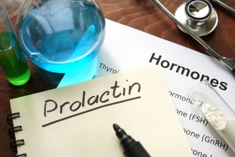 Prolactin Levels Everything You Need to Know Women Fitness Org