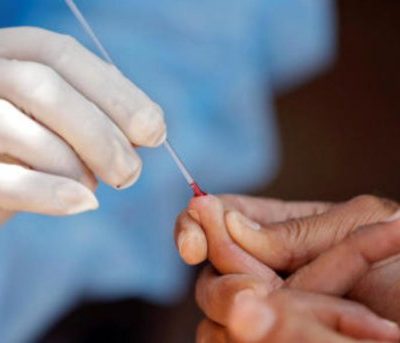 66 medical students, fully vaccinated, test Covid-19 positive in Karnataka college