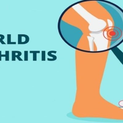 World Arthritis Day: Early signs of joint disease
