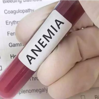 Indian scientists develop iron jabs, to help check anaemia